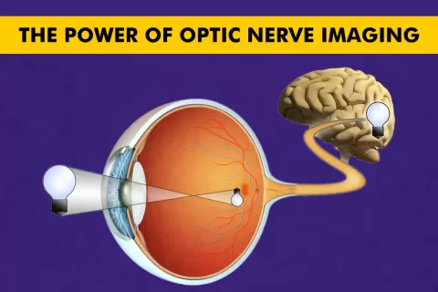 Cataract Surgery – How To Choose The Best Eye Care Center?