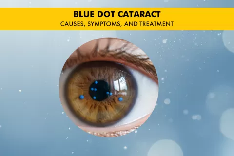 Cataract Surgery – How To Choose The Best Eye Care Center?