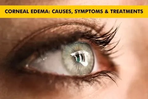 Cataract Surgery – How To Choose The Best Eye Care Center?