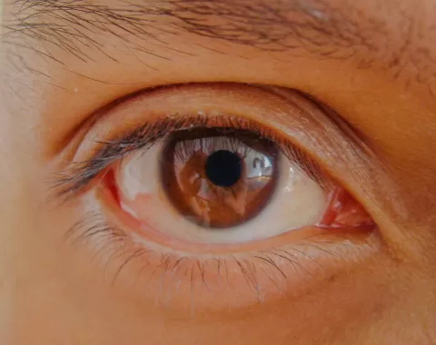 Cataract Surgery – How To Choose The Best Eye Care Center?