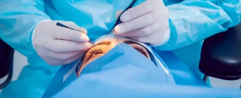 Cataract Surgery – How To Choose The Best Eye Care Center?