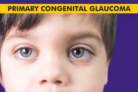 Cataract Surgery – How To Choose The Best Eye Care Center?