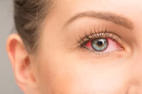 Cataract Surgery – How To Choose The Best Eye Care Center?