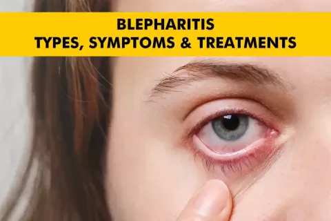 Cataract Surgery – How To Choose The Best Eye Care Center?