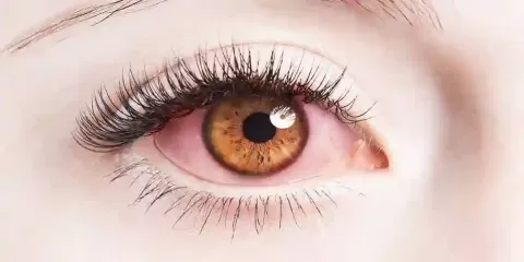 Cataract Surgery – How To Choose The Best Eye Care Center?