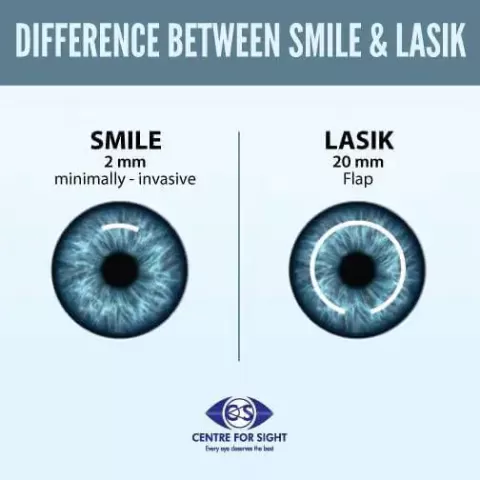 Cataract Surgery – How To Choose The Best Eye Care Center?