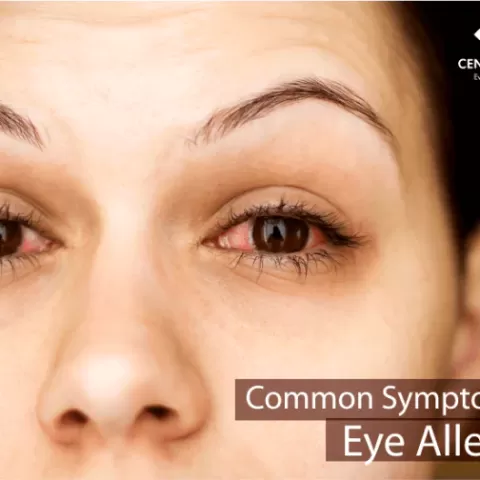 Cataract Surgery – How To Choose The Best Eye Care Center?