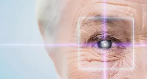 Cataract Surgery – How To Choose The Best Eye Care Center?