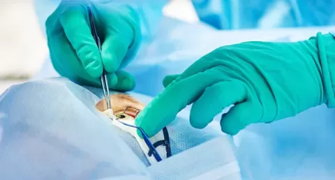 Cataract Surgery – How To Choose The Best Eye Care Center?