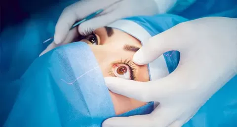 Cataract Surgery – How To Choose The Best Eye Care Center?