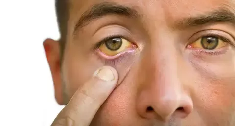 Cataract Surgery – How To Choose The Best Eye Care Center?